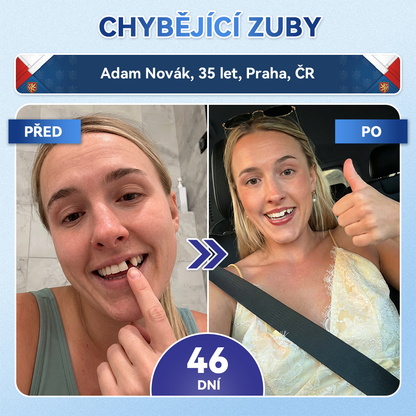 🎊Glimmerly® 🦷Microneedle naplast pro opravu zubi a dasni s Tideglusibem  |Pokročilé zubní pásky s aktivací kmenových buněk (obnovuje sklovinu a dentin • posiluje dásně • odstraňuje plak a zápach • zastavuje citlivost zubů) 3.0