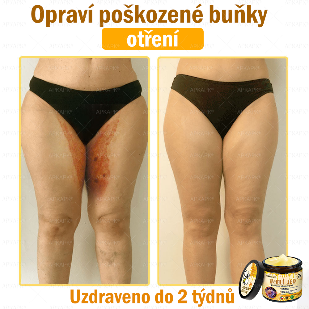 🐝Dermatologicky a klinicky testováno👩‍⚕️APKAPK®Bee Venom Krém na obnovení pleti🐝 pomáhá při léčbě kožních problémů, jako jsou: vrásky, jizvy, pigmentové skvrny, strie, akné, psoriáza, ekzém, kožní změny, podráždění, záněty a další kožní problémy.