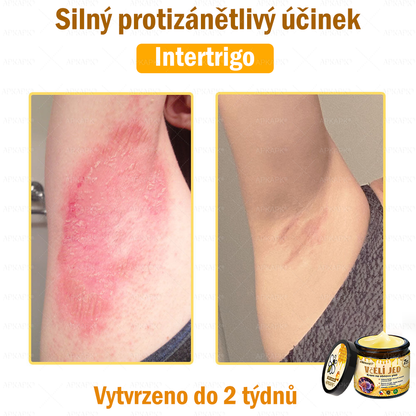 🐝Dermatologicky a klinicky testováno👩‍⚕️APKAPK®Bee Venom Krém na obnovení pleti🐝 pomáhá při léčbě kožních problémů, jako jsou: vrásky, jizvy, pigmentové skvrny, strie, akné, psoriáza, ekzém, kožní změny, podráždění, záněty a další kožní problémy.