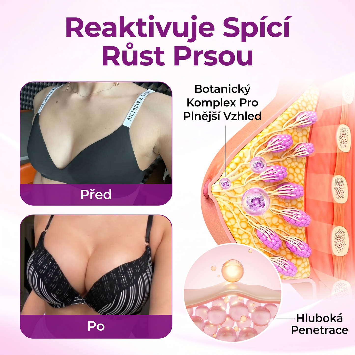 ✔️Timilk® MAXKŘIVKY TVAROVACÍ A OBJEMOVÝ PRSNÍ OLEJ