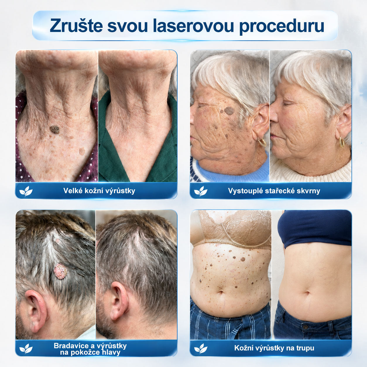 🌟🌟𝐎𝐟𝐢𝐜𝐢á𝐥𝐧í 𝐳𝐧𝐚č𝐤𝐨𝐯á 𝐩𝐫𝐨𝐝𝐞𝐣𝐧𝐚  𝐏𝐢𝐜𝐝𝐨® 𝟕𝐝𝐞𝐧𝐧í 𝐨𝐝𝐬𝐭𝐫𝐚ň𝐨𝐯𝐚č   𝐤𝐨ž𝐧í𝐜𝐡 𝐯ý𝐫ů𝐬𝐭𝐤ů 𝐚 𝐬𝐤𝐯𝐫𝐧(Nulová bolest, nulová kulička Rollerball)