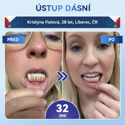 🎊Glimmerly® 🦷Microneedle naplast pro opravu zubi a dasni s Tideglusibem  |Pokročilé zubní pásky s aktivací kmenových buněk (obnovuje sklovinu a dentin • posiluje dásně • odstraňuje plak a zápach • zastavuje citlivost zubů) 3.0