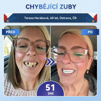 🎊Glimmerly® 🦷Microneedle naplast pro opravu zubi a dasni s Tideglusibem  |Pokročilé zubní pásky s aktivací kmenových buněk (obnovuje sklovinu a dentin • posiluje dásně • odstraňuje plak a zápach • zastavuje citlivost zubů) 3.0