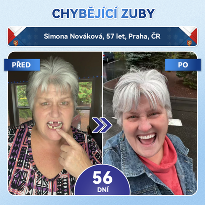 🎊Glimmerly® 🦷Microneedle naplast pro opravu zubi a dasni s Tideglusibem  |Pokročilé zubní pásky s aktivací kmenových buněk (obnovuje sklovinu a dentin • posiluje dásně • odstraňuje plak a zápach • zastavuje citlivost zubů) 3.0