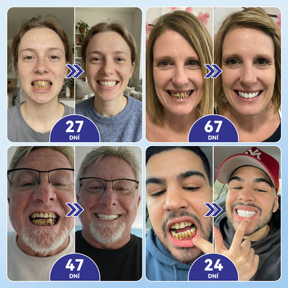 🎊Glimmerly® 🦷Microneedle naplast pro opravu zubi a dasni s Tideglusibem  |Pokročilé zubní pásky s aktivací kmenových buněk (obnovuje sklovinu a dentin • posiluje dásně • odstraňuje plak a zápach • zastavuje citlivost zubů) 3.0