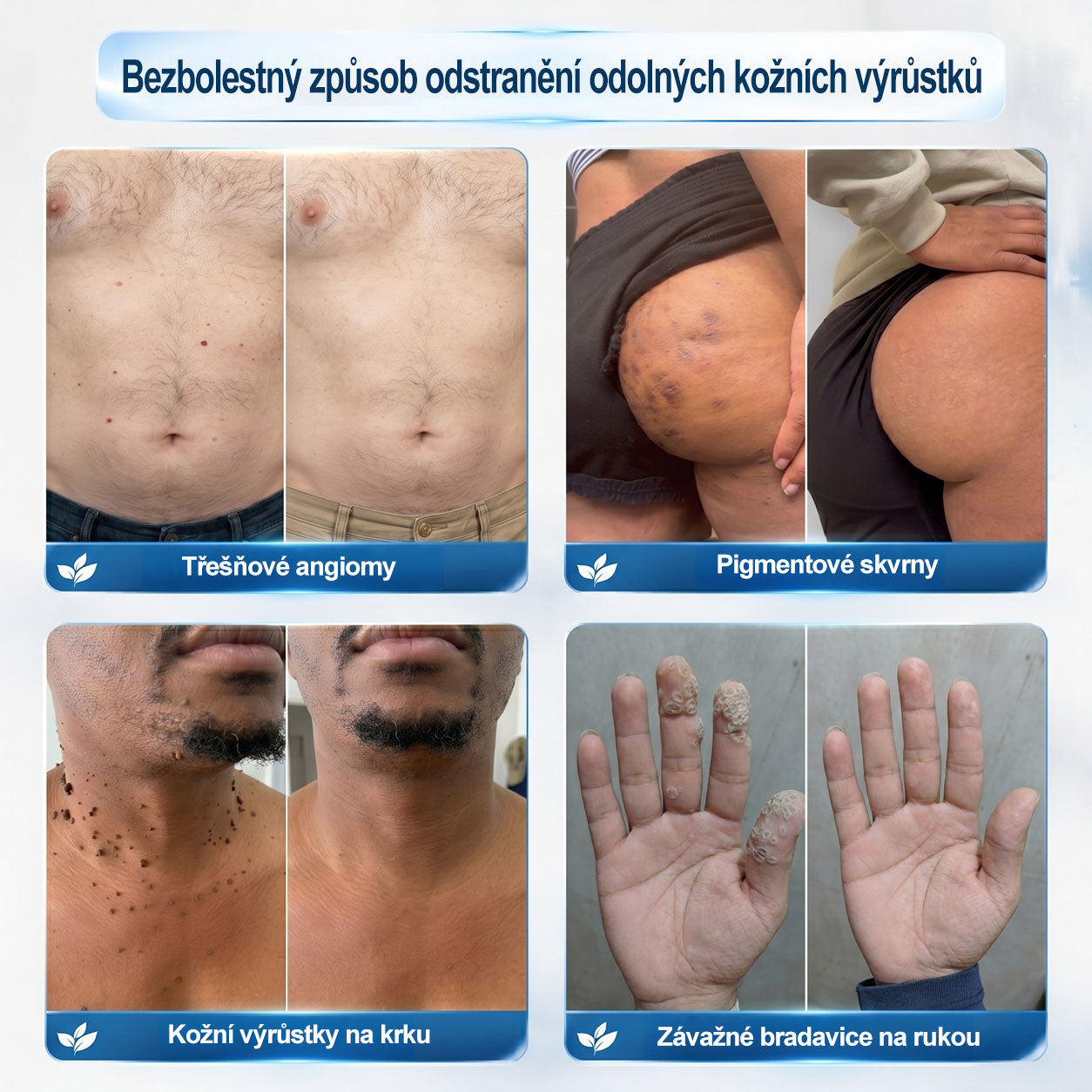🌟🌟𝐎𝐟𝐢𝐜𝐢á𝐥𝐧í 𝐳𝐧𝐚č𝐤𝐨𝐯á 𝐩𝐫𝐨𝐝𝐞𝐣𝐧𝐚  𝐏𝐢𝐜𝐝𝐨® 𝟕𝐝𝐞𝐧𝐧í 𝐨𝐝𝐬𝐭𝐫𝐚ň𝐨𝐯𝐚č   𝐤𝐨ž𝐧í𝐜𝐡 𝐯ý𝐫ů𝐬𝐭𝐤ů 𝐚 𝐬𝐤𝐯𝐫𝐧(Nulová bolest, nulová kulička Rollerball)