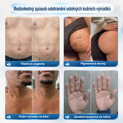🌟🌟𝐎𝐟𝐢𝐜𝐢á𝐥𝐧í 𝐳𝐧𝐚č𝐤𝐨𝐯á 𝐩𝐫𝐨𝐝𝐞𝐣𝐧𝐚  𝐏𝐢𝐜𝐝𝐨® 𝟕𝐝𝐞𝐧𝐧í 𝐨𝐝𝐬𝐭𝐫𝐚ň𝐨𝐯𝐚č   𝐤𝐨ž𝐧í𝐜𝐡 𝐯ý𝐫ů𝐬𝐭𝐤ů 𝐚 𝐬𝐤𝐯𝐫𝐧(Nulová bolest, nulová kulička Rollerball)