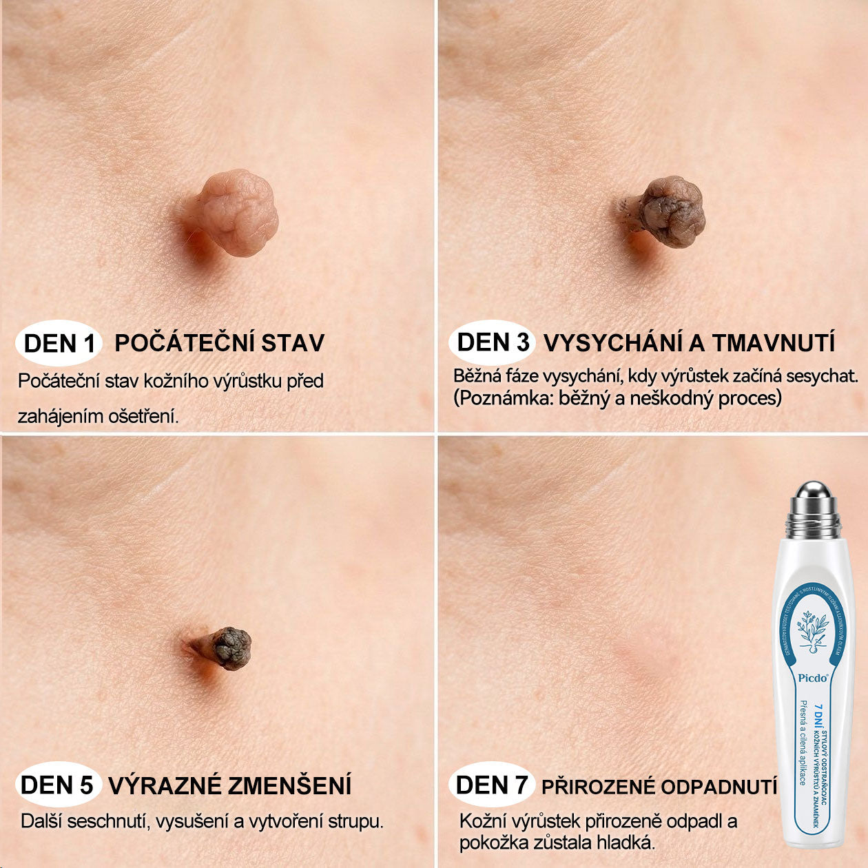 🌟🌟𝐎𝐟𝐢𝐜𝐢á𝐥𝐧í 𝐳𝐧𝐚č𝐤𝐨𝐯á 𝐩𝐫𝐨𝐝𝐞𝐣𝐧𝐚  𝐏𝐢𝐜𝐝𝐨® 𝟕𝐝𝐞𝐧𝐧í 𝐨𝐝𝐬𝐭𝐫𝐚ň𝐨𝐯𝐚č   𝐤𝐨ž𝐧í𝐜𝐡 𝐯ý𝐫ů𝐬𝐭𝐤ů 𝐚 𝐬𝐤𝐯𝐫𝐧(Nulová bolest, nulová kulička Rollerball)