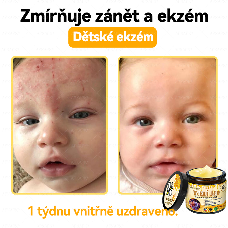 🐝Dermatologicky a klinicky testováno👩‍⚕️APKAPK®Bee Venom Krém na obnovení pleti🐝 pomáhá při léčbě kožních problémů, jako jsou: vrásky, jizvy, pigmentové skvrny, strie, akné, psoriáza, ekzém, kožní změny, podráždění, záněty a další kožní problémy.