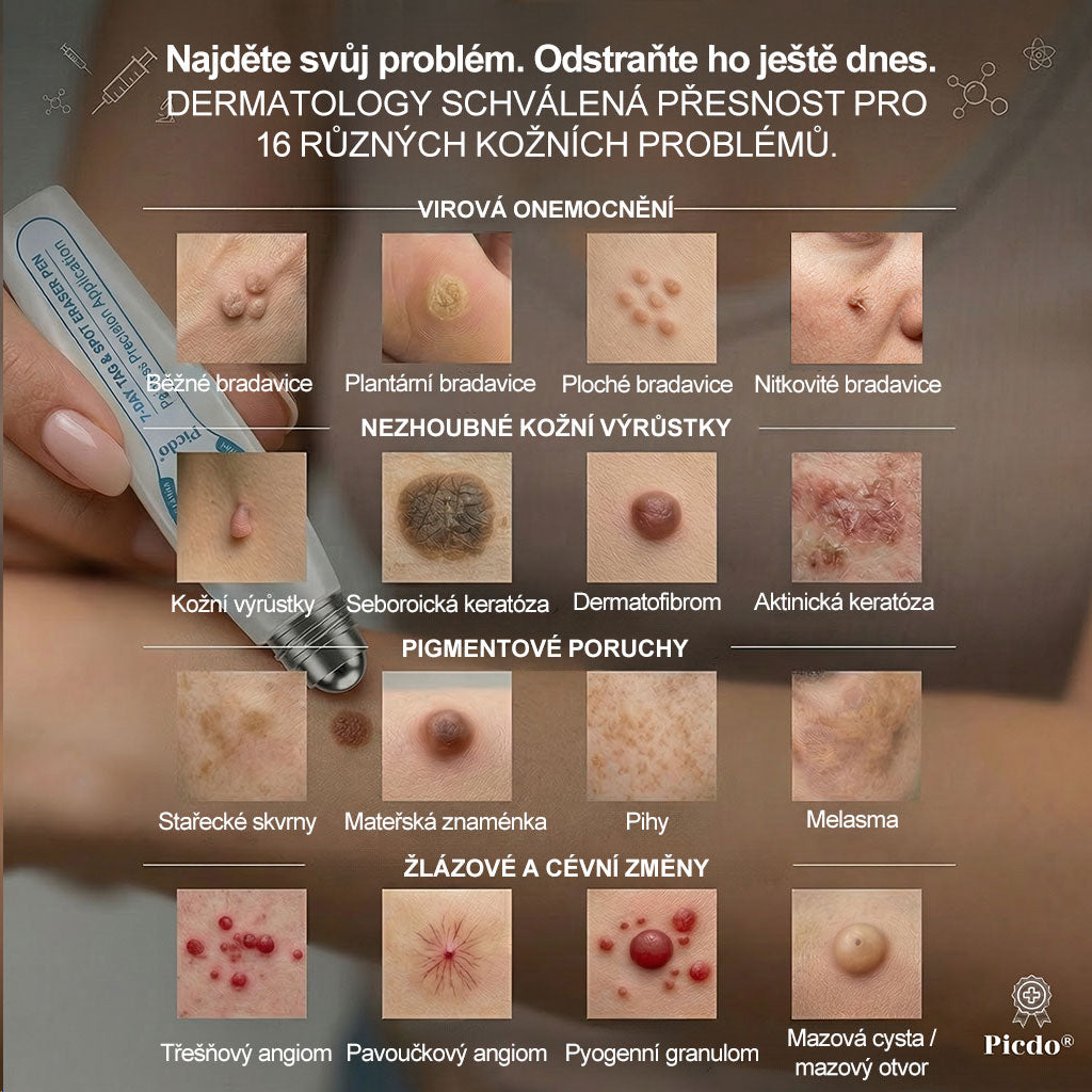 🌟🌟𝐎𝐟𝐢𝐜𝐢á𝐥𝐧í 𝐳𝐧𝐚č𝐤𝐨𝐯á 𝐩𝐫𝐨𝐝𝐞𝐣𝐧𝐚  𝐏𝐢𝐜𝐝𝐨® 𝟕𝐝𝐞𝐧𝐧í 𝐨𝐝𝐬𝐭𝐫𝐚ň𝐨𝐯𝐚č   𝐤𝐨ž𝐧í𝐜𝐡 𝐯ý𝐫ů𝐬𝐭𝐤ů 𝐚 𝐬𝐤𝐯𝐫𝐧(Nulová bolest, nulová kulička Rollerball)